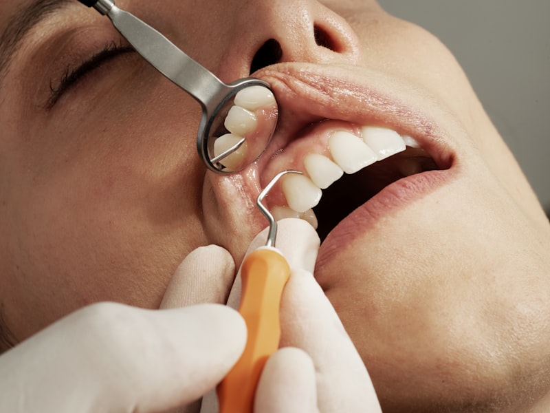 Root Canal Treatment (Endodontics)